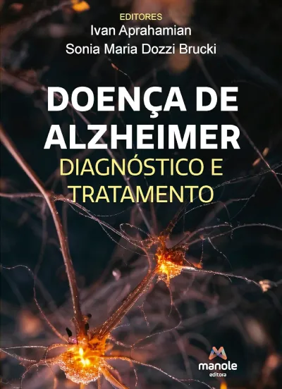 Doença De Alzheimer Diagnóstico E Tratamento